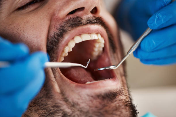 Best Dentist for Severe Toothache  in Sewalls Point, FL